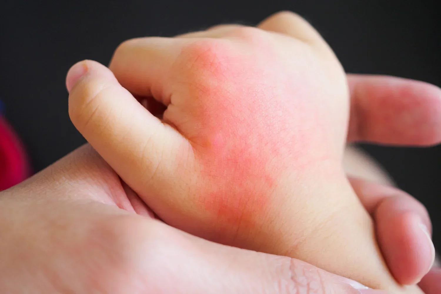baby clothes sensitive skin